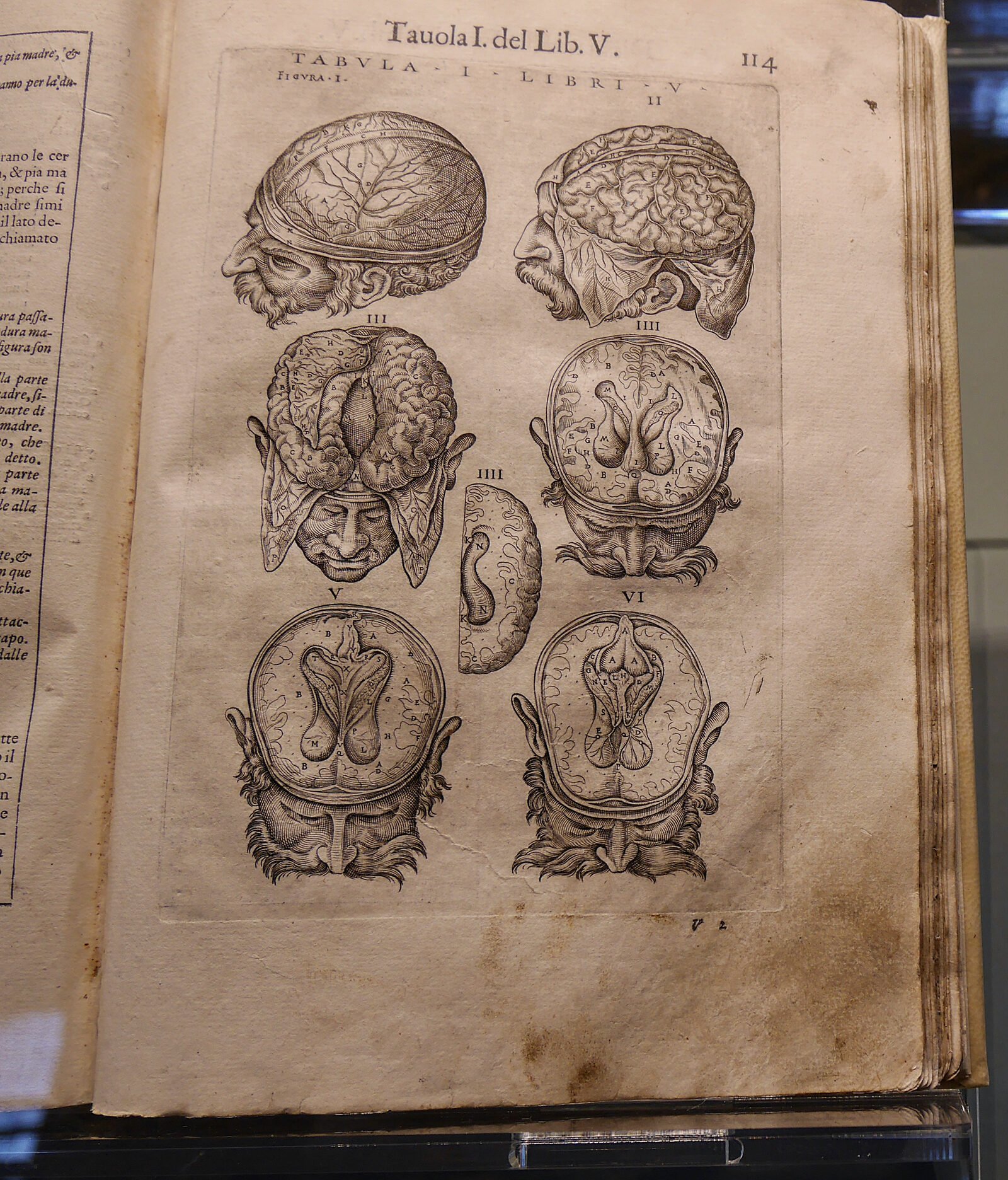 Scuola Grande San Marco : The medical museum houses over 8,000 medical tomes, including works by ancient physicians such as Hippocrates